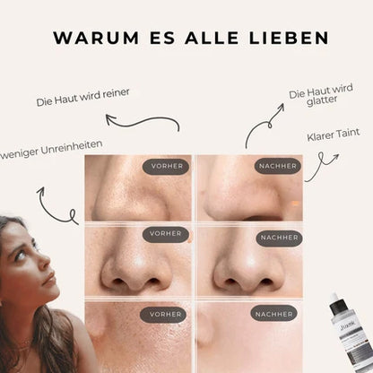 Korean Glow Rice Peeling Ampoule Duo – Sanftes Peeling für strahlende Haut